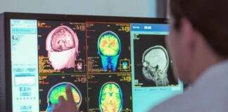 Adolescence lasts into 30s – new study shows four pivotal ages for your brain